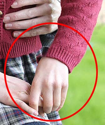 Sarolta hercegnő keze