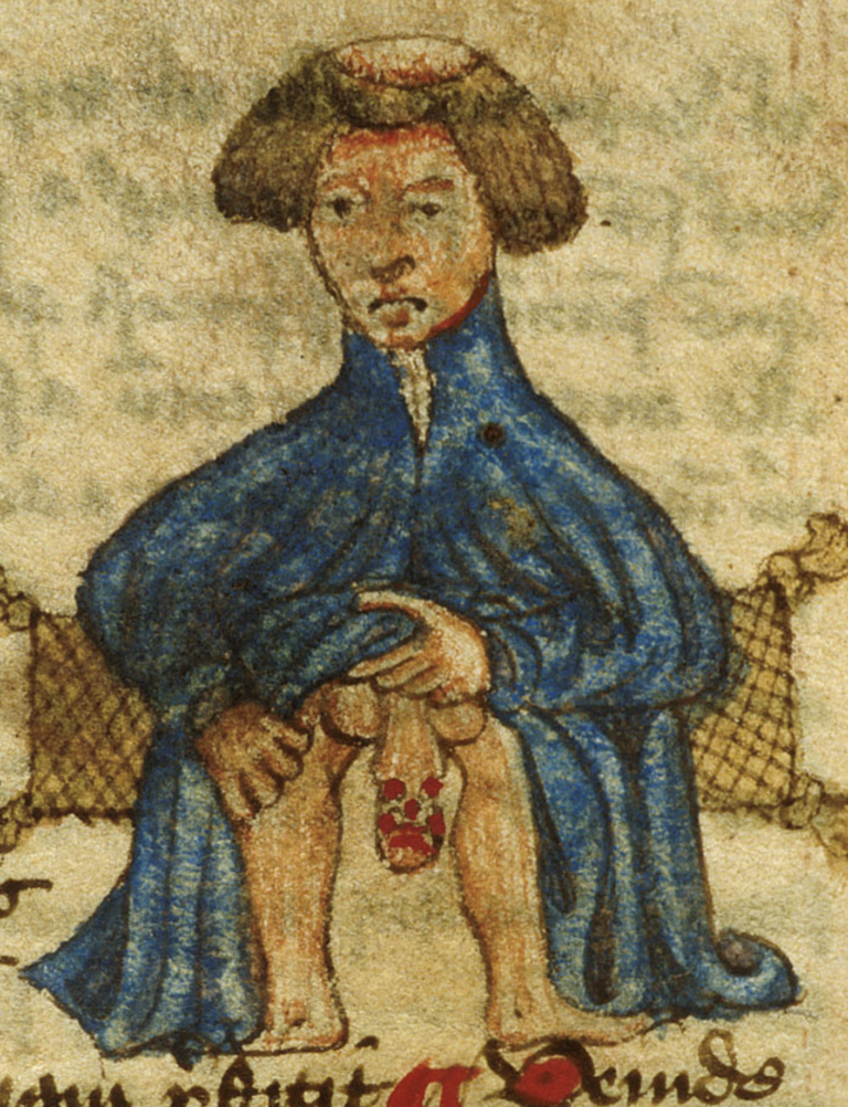 Gyulladt középkori pénisz (forrás: Wikimedia Commons)