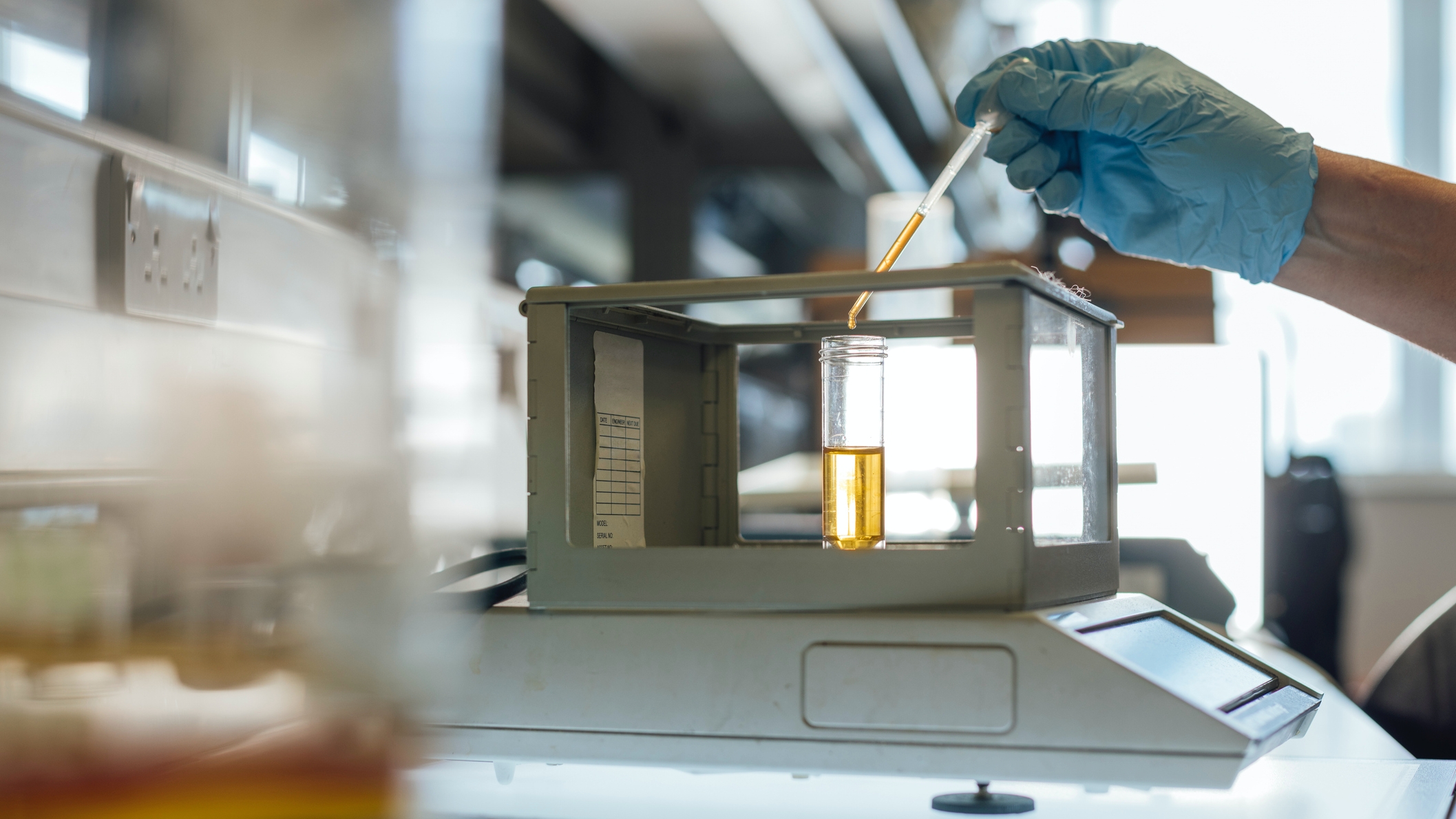 Mi az a leukocita észteráz? – Ezt kell tudnod, ha meglátod a laboreredményedben