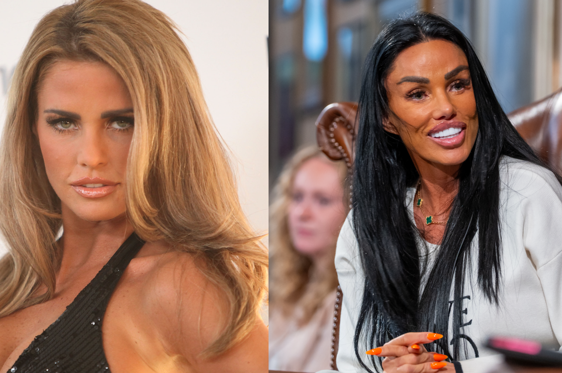 katie price előtte-utána