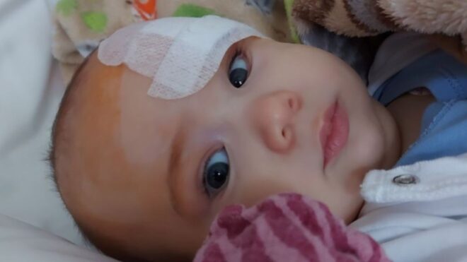 Méregdrága gyógyszer kell a két éves Bertold gyógyulásához – segítséget kér a család