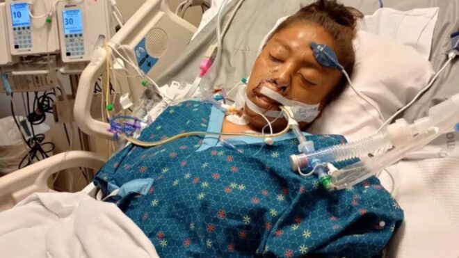 Kutyák támadtak a bicikliző nőre: mind a négy végtagját amputálni kellett