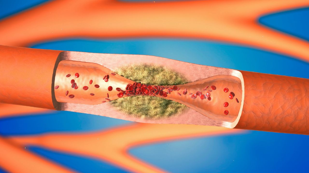 Az érsebész 3 természetes módszert javasol az artériák tisztán tartására és a szív egészségének védelmére