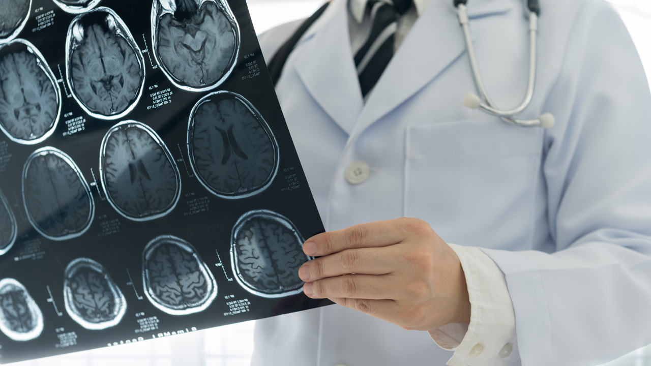 Golyóval a fejében él 40 éve egy gyöngyösi férfi