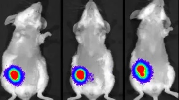 Egy kezeléssel teljesen elpusztultak a rákos sejtek: az áttörés még a magyar kutatókat is meglepte