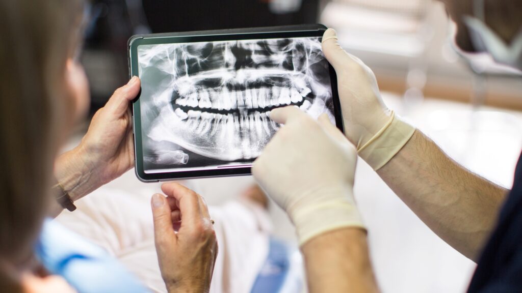 Fogorvos és páciense nézi a panorámaröntgent.