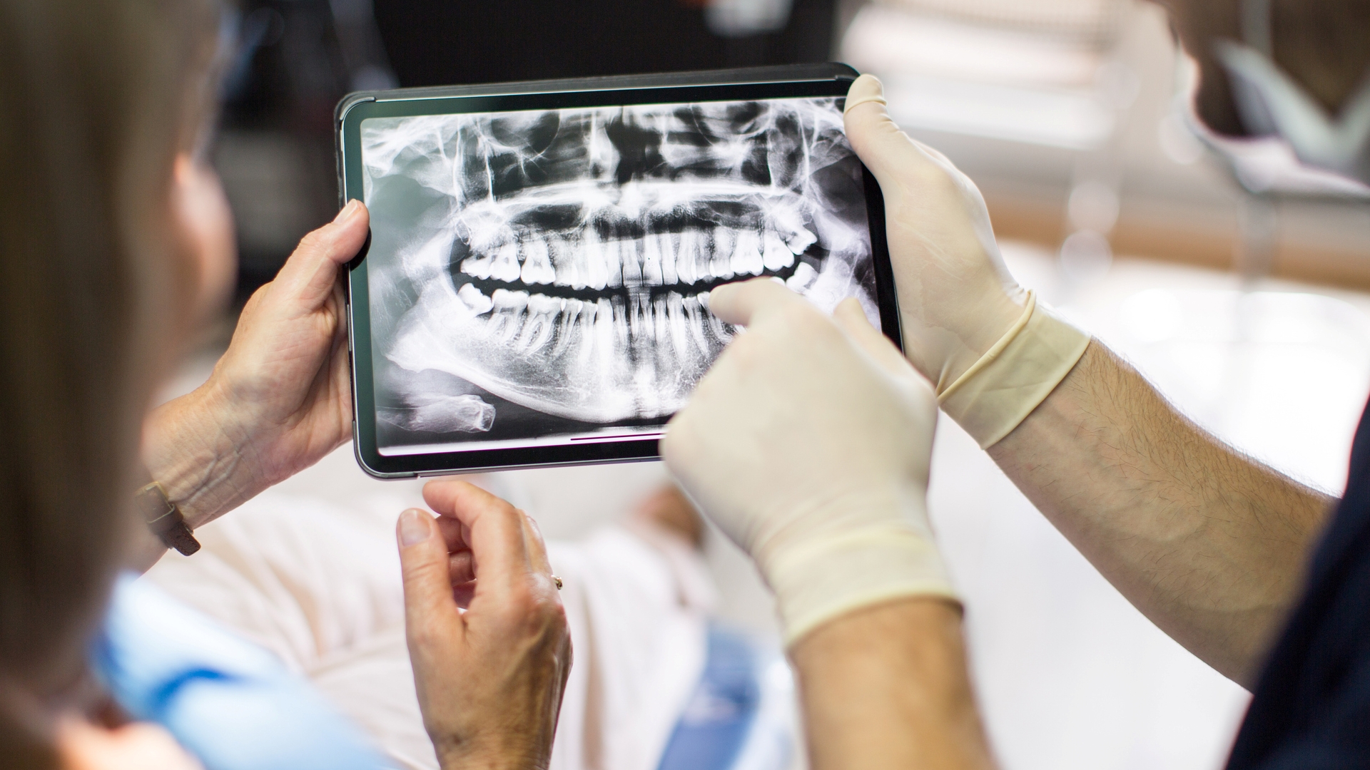 A fogászati implantátum kétélű fegyver. Miért ennyire népszerű mégis?