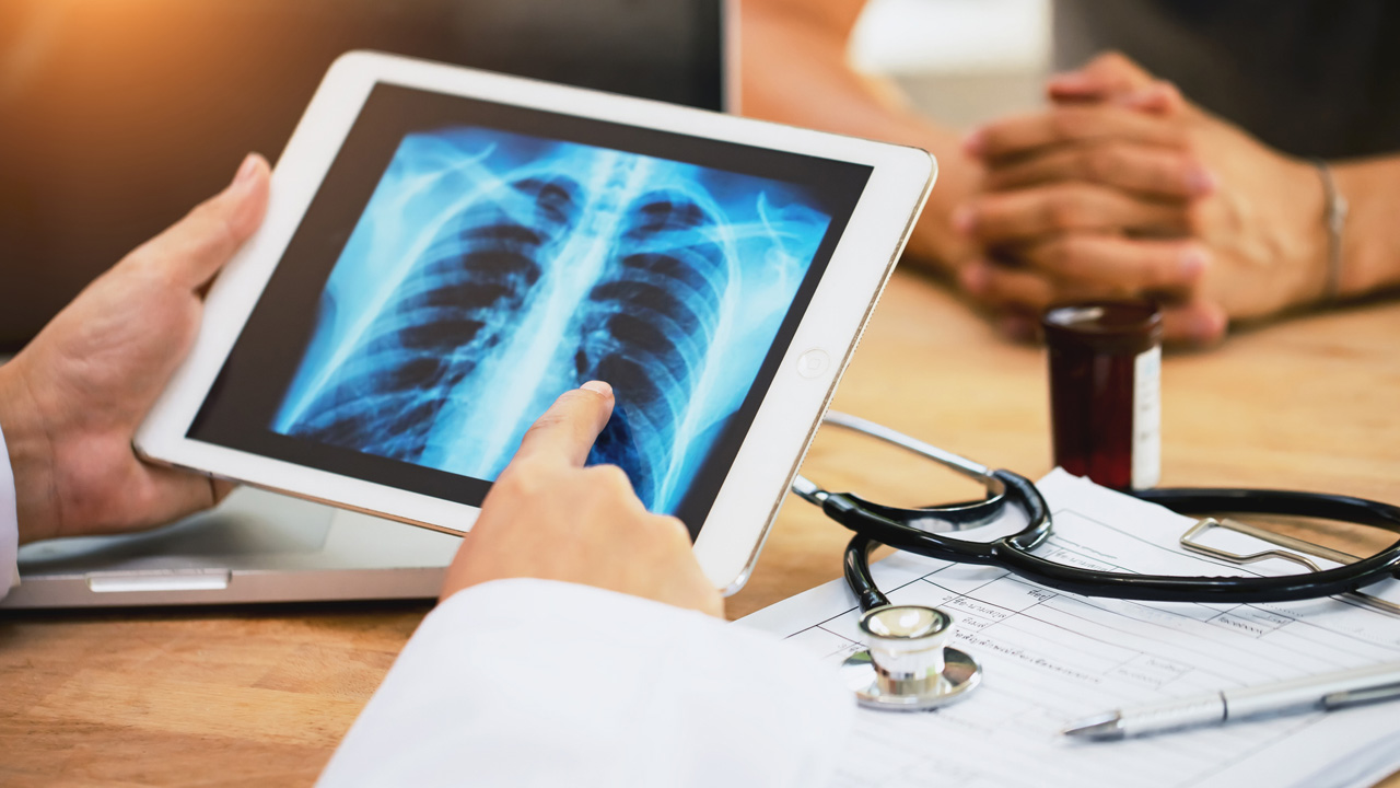 TBC - fotó: Getty Images